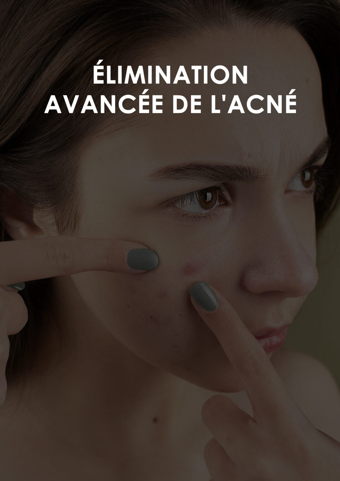Élimination avancée de l'acné